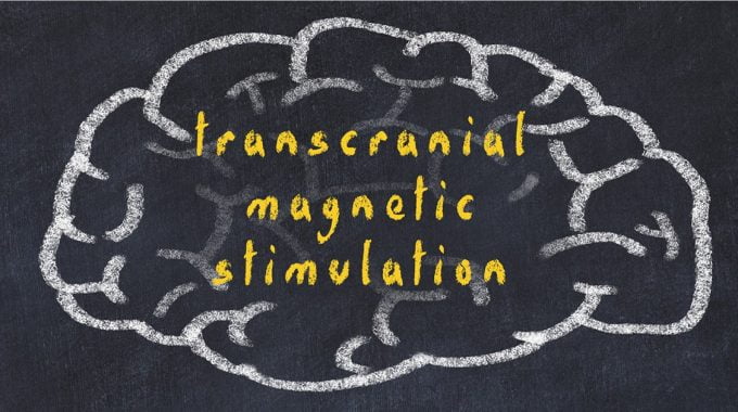 FDA Approves TMS As Form Of OCD Treatment